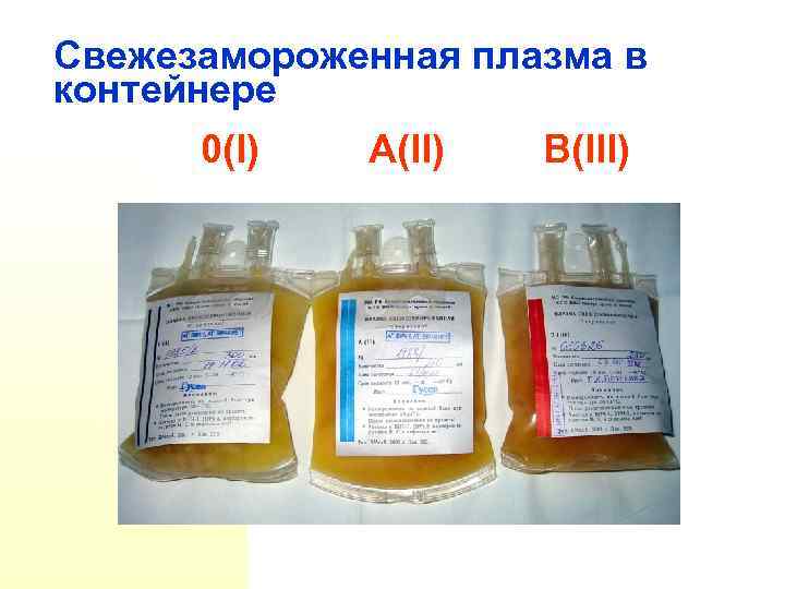 Свежезамороженная плазма в контейнере 0(I) А(II) B(III) 