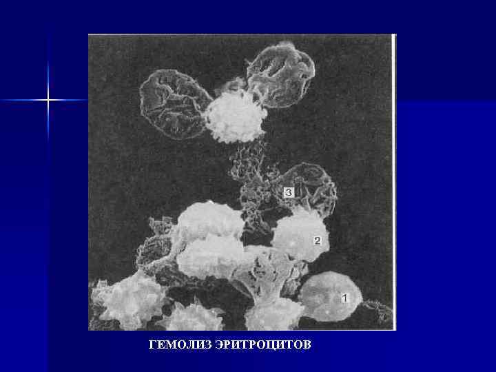 ГЕМОЛИЗ ЭРИТРОЦИТОВ 