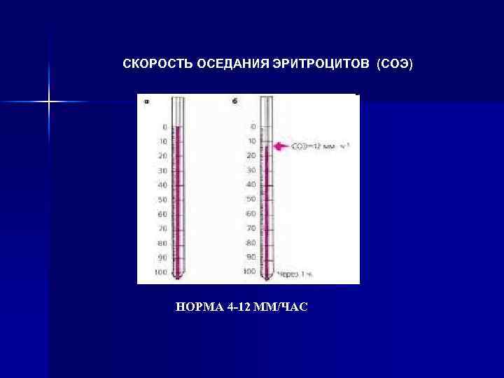 СКОРОСТЬ ОСЕДАНИЯ ЭРИТРОЦИТОВ (СОЭ) НОРМА 4 -12 ММ/ЧАС 