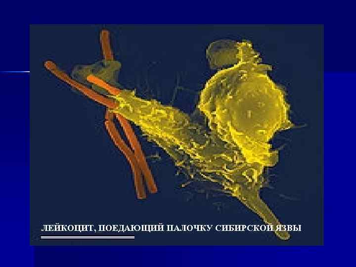 ЛЕЙКОЦИТ, ПОЕДАЮЩИЙ ПАЛОЧКУ СИБИРСКОЙ ЯЗВЫ 