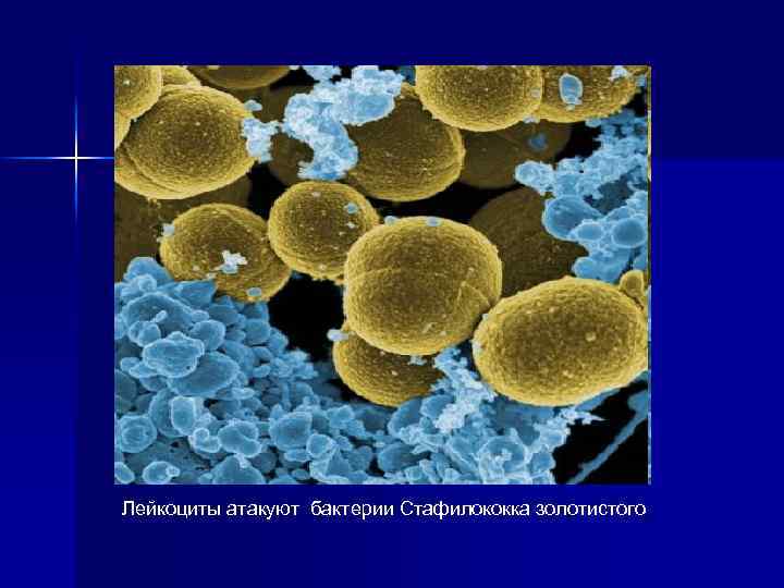 Лейкоциты атакуют бактерии Стафилококка золотистого 