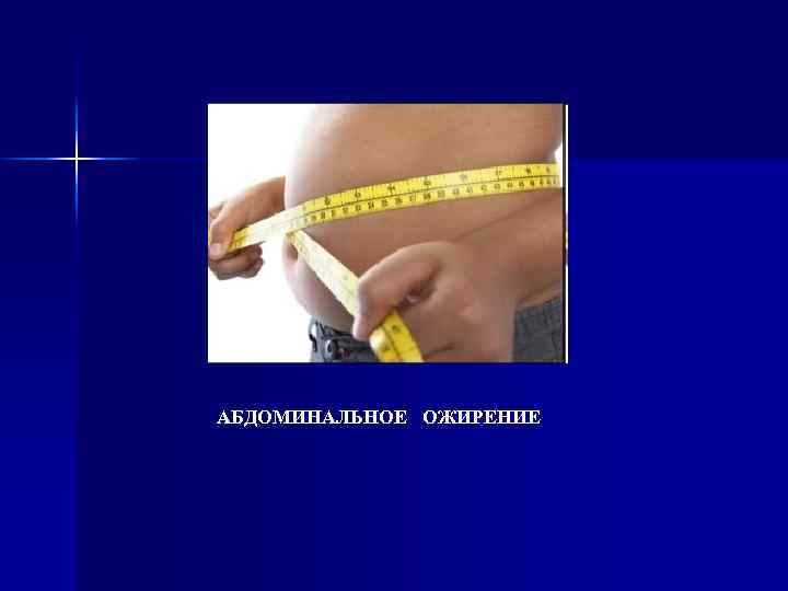 АБДОМИНАЛЬНОЕ ОЖИРЕНИЕ 