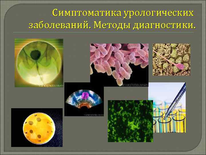 Симптоматика урологических заболеваний. Методы диагностики. 