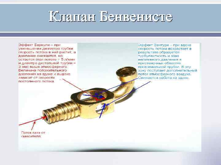 Клапан Бенвенисте 