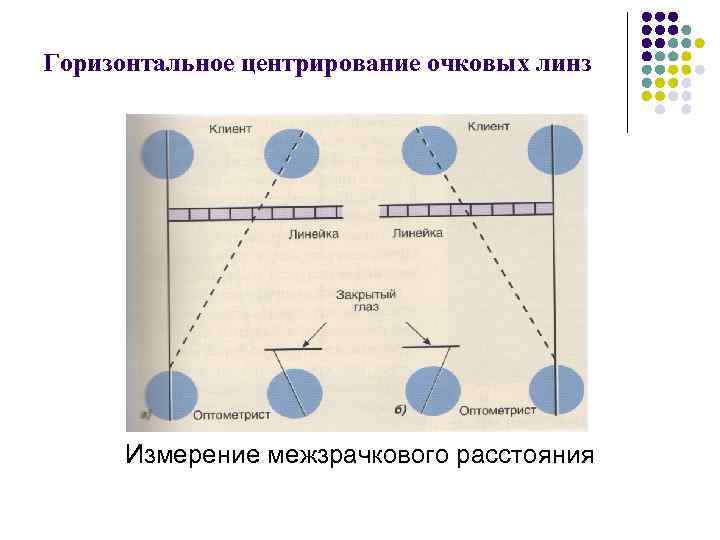 Выгорание линз в фарах