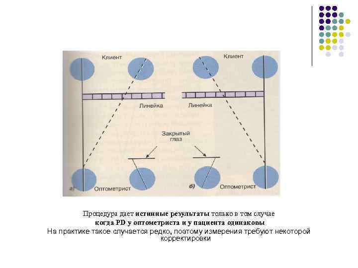 Процедура дает истинные результаты только в том случае когда PD у оптометриста и у