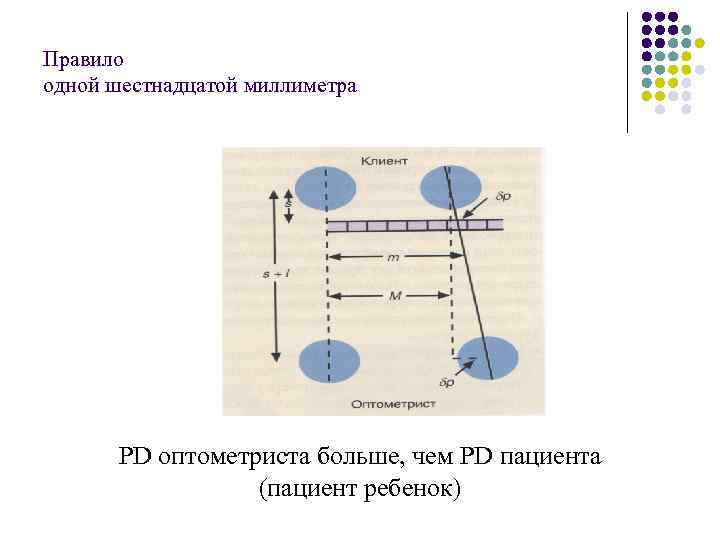 Правило одной шестнадцатой миллиметра PD оптометриста больше, чем PD пациента (пациент ребенок) 