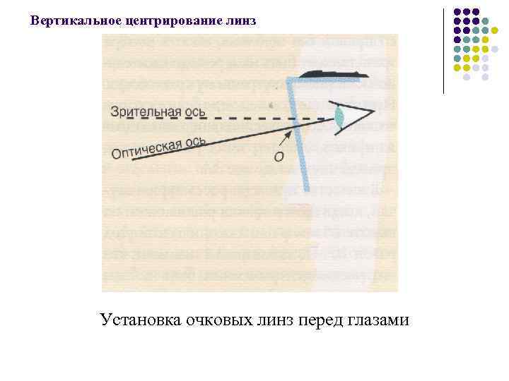 Вертикальное центрирование линз Установка очковых линз перед глазами 