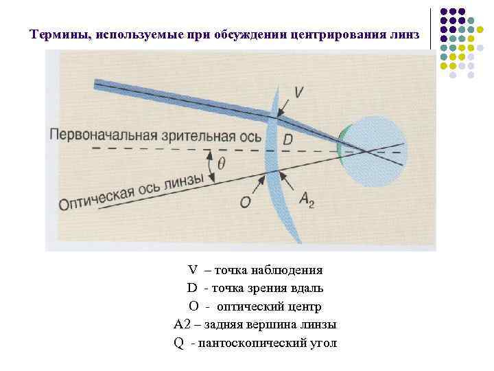 Задней вершинной рефракции