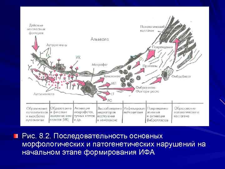 Рис. 9. Идиопатический фиброзирующий альвеолит. А рентгенограмма, Б ЭРТГ. Диффузное усиление легочного рисунка за