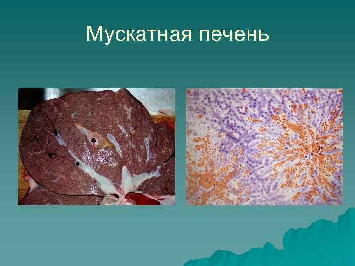 Мускатная печень 