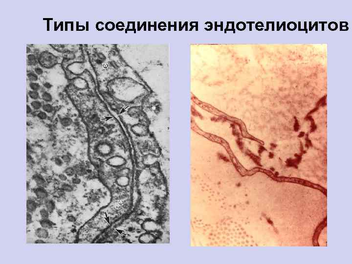 Типы соединения эндотелиоцитов 