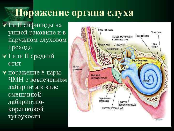 Поражение органа слуха Ú I и II сифилиды на ушной раковине и в наружном