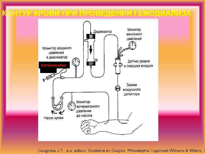 КОНТУР КРОВИ ПРОВЕДЕНИИ ГЕМОДИАЛИЗА Антикоагулян ты Daugirdas J. T. , e. a. editors. Guideline