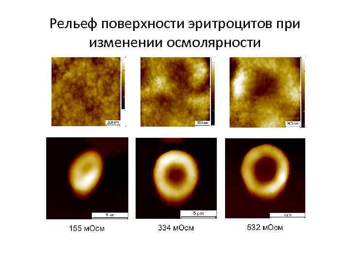 Рельеф поверхности эритроцитов при изменении осмолярности 