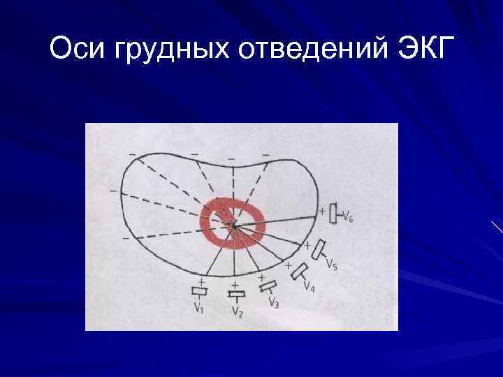 Оси грудных отведений ЭКГ 