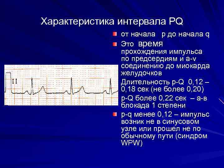 Характеристика интервала РQ от начала p до начала q Это время прохождения импульса по
