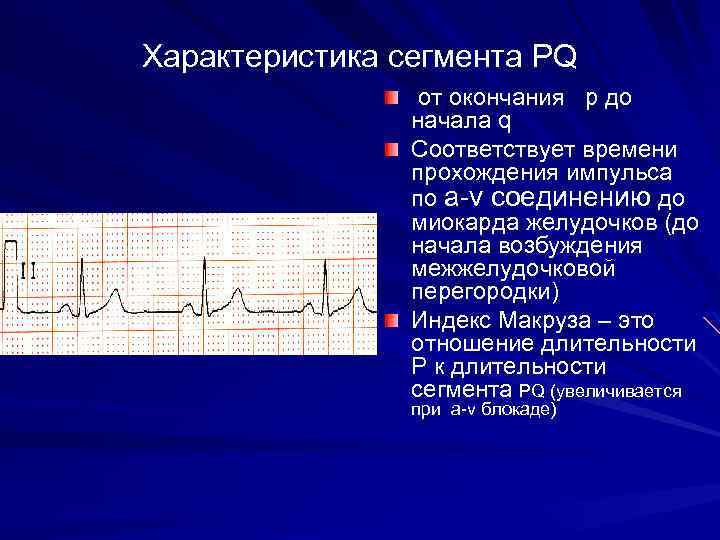 Характеристика сегмента РQ от окончания p до начала q Соответствует времени прохождения импульса по