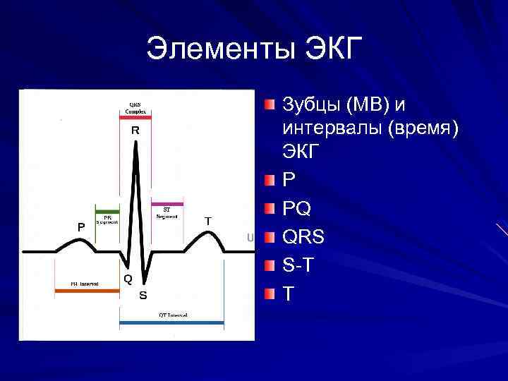 Элементы ЭКГ Зубцы (МВ) и интервалы (время) ЭКГ P PQ QRS S-T T 