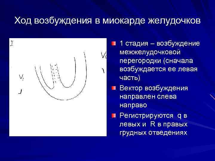 Ход возбуждения в миокарде желудочков 1 стадия – возбуждение межжелудочковой перегородки (сначала возбуждается ее