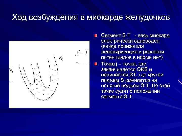 Ход возбуждения в миокарде желудочков Сегмент S-T - весь миокард электрически однороден (везде произошла