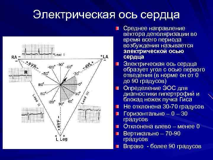 Электрическая ось сердца Среднее направление вектора деполяризации во время всего периода возбуждения называется электрической