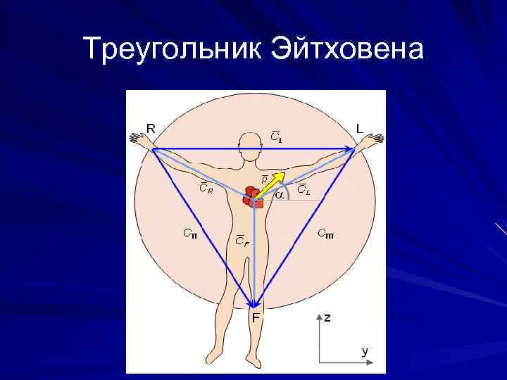 Треугольник Эйтховена 
