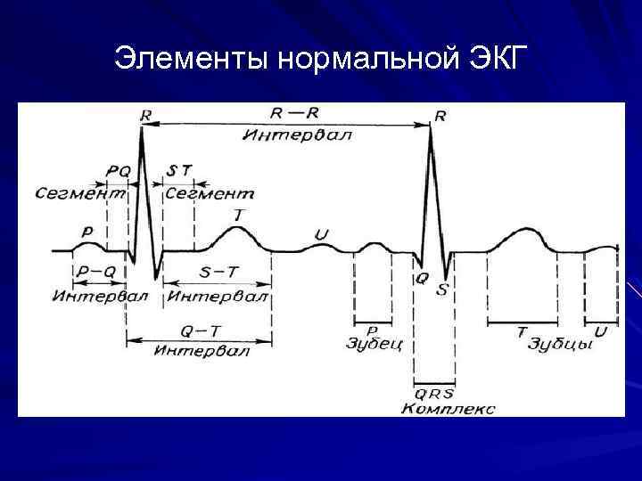 Элементы нормальной ЭКГ 