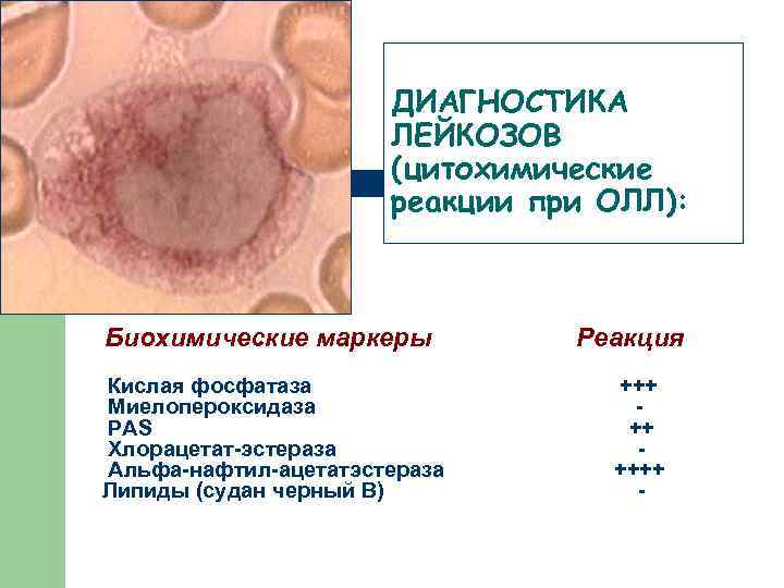 ДИАГНОСТИКА ЛЕЙКОЗОВ (цитохимические реакции при ОЛЛ): Биохимические маркеры Кислая фосфатаза Миелопероксидаза PAS Хлорацетат-эстераза Альфа-нафтил-ацетатэстераза