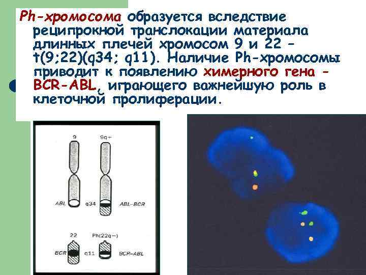Ph-хромосома образуется вследствие реципрокной транслокации материала длинных плечей хромосом 9 и 22 – t(9;