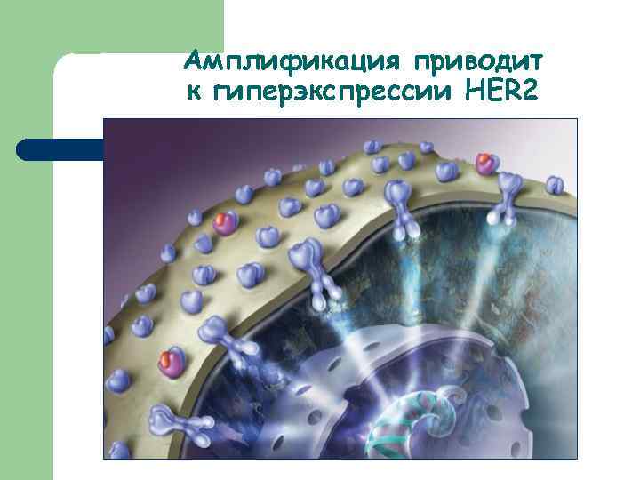 Амплификация приводит к гиперэкспрессии HER 2 