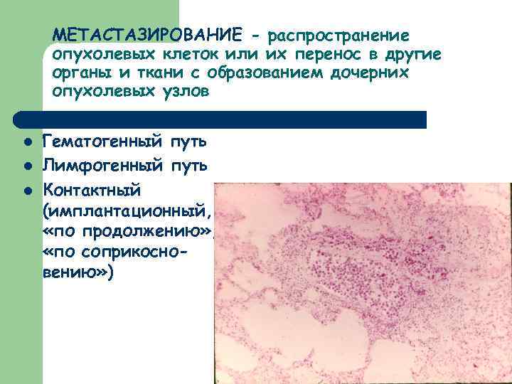 МЕТАСТАЗИРОВАНИЕ - распространение опухолевых клеток или их перенос в другие органы и ткани с