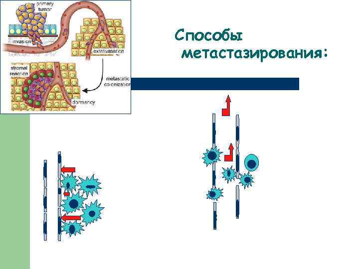 Способы метастазирования: 