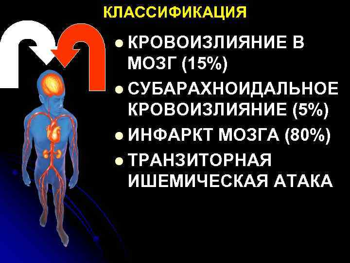 КЛАССИФИКАЦИЯ l КРОВОИЗЛИЯНИЕ В МОЗГ (15%) l СУБАРАХНОИДАЛЬНОЕ КРОВОИЗЛИЯНИЕ (5%) l ИНФАРКТ МОЗГА (80%)