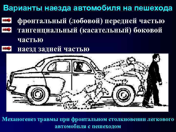 Варианты наезда автомобиля на пешехода фронтальный (лобовой) передней частью тангенциальный (касательный) боковой частью наезд Варианты наезда автомобиля на пешехода фронтальный (лобовой) передней частью тангенциальный (касательный) боковой частью наезд