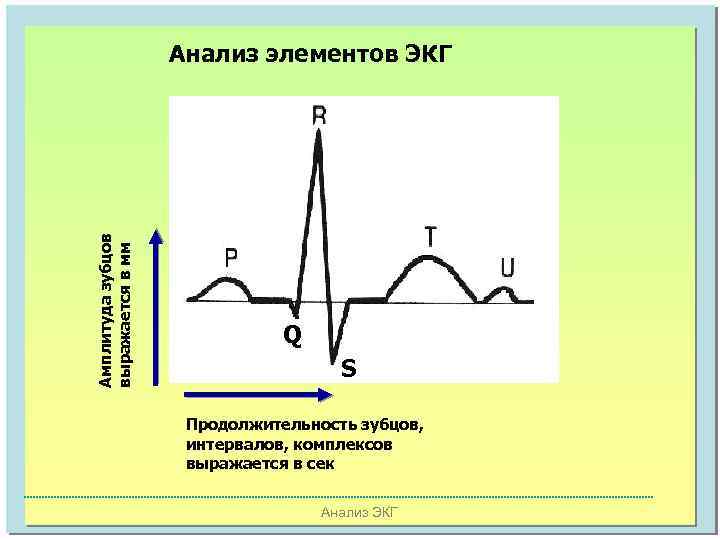 Амплитуда зубцов выражается в мм Анализ элементов ЭКГ Q S Продолжительность зубцов, интервалов, комплексов