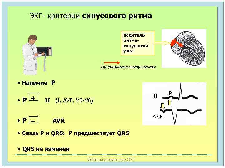 ЭКГ- критерии синусового ритма водитель ритмасинусовый узел Направление возбуждения • Наличие Р • Р