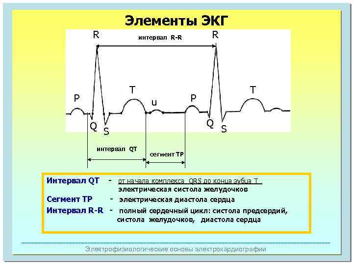 Элементы ЭКГ R T P u Q R интервал R-R T P Q S
