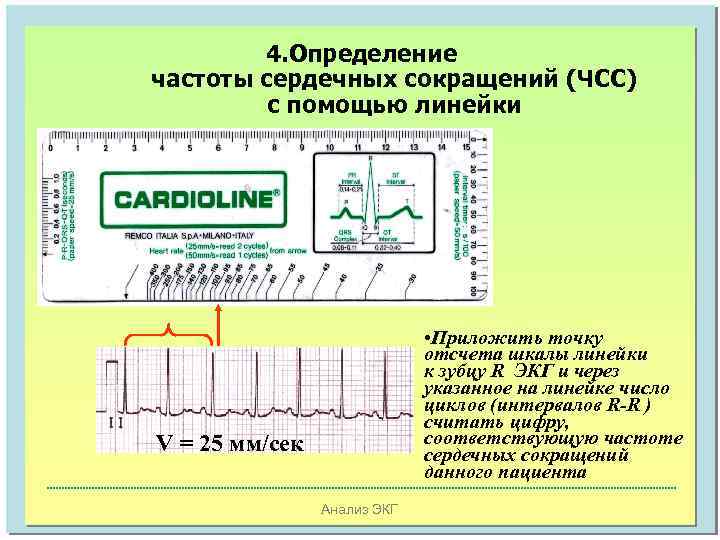 4. Определение частоты сердечных сокращений (ЧСС) с помощью линейки • Приложить точку отсчета шкалы