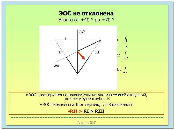 ЭОС не отклонена Угол α от +40 ° до +70 ° AVF _ +