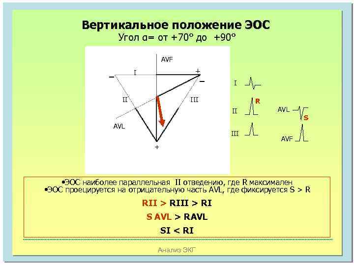 Вертикальное положение ЭОС Угол α= от +70° до +90° AVF _ + _ I