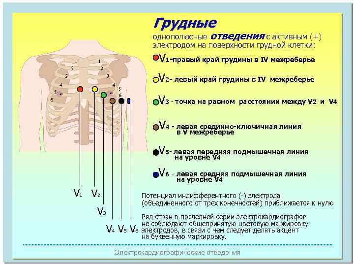 Грудные однополюсные отведения с активным (+) электродом на поверхности грудной клетки: 1 2 V