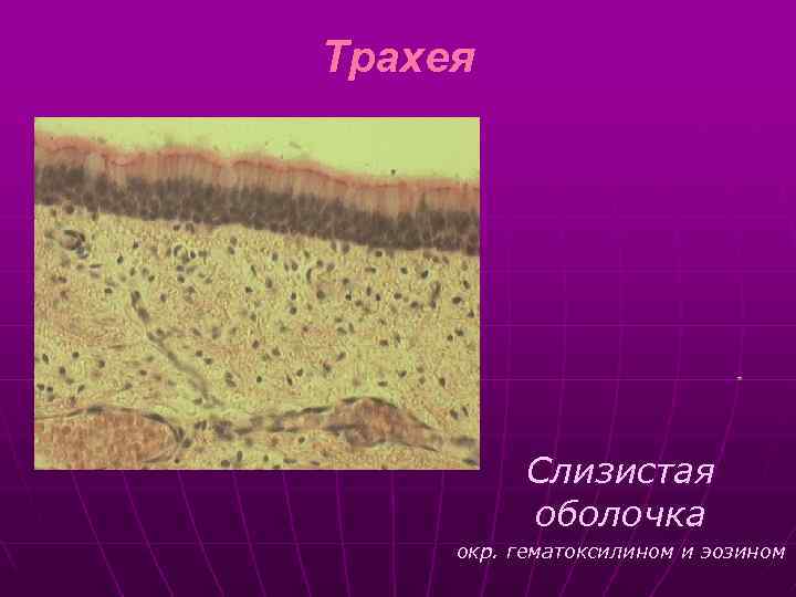 Трахея Слизистая оболочка окр. гематоксилином и эозином 