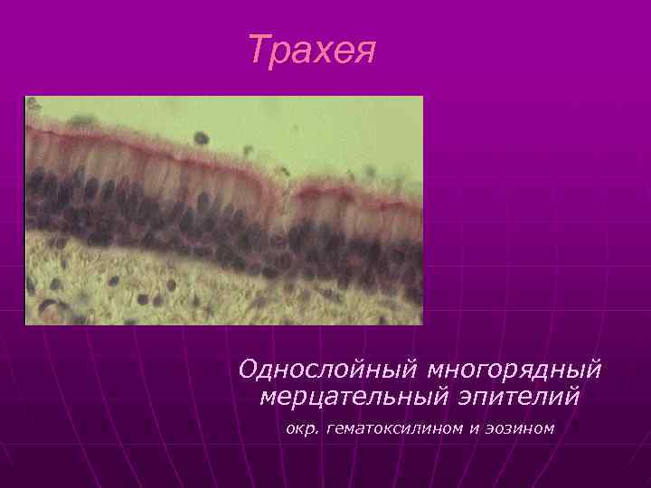 Трахея Однослойный многорядный мерцательный эпителий окр. гематоксилином и эозином 