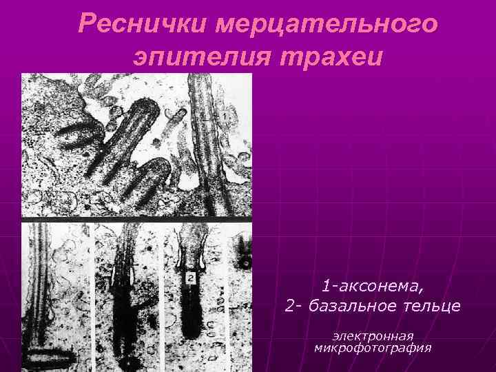Реснички мерцательного эпителия трахеи 1 -аксонема, 2 - базальное тельце электронная микрофотография 