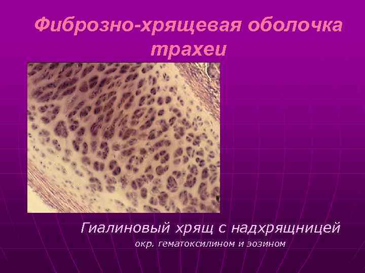 Фиброзно-хрящевая оболочка трахеи Гиалиновый хрящ с надхрящницей окр. гематоксилином и эозином 
