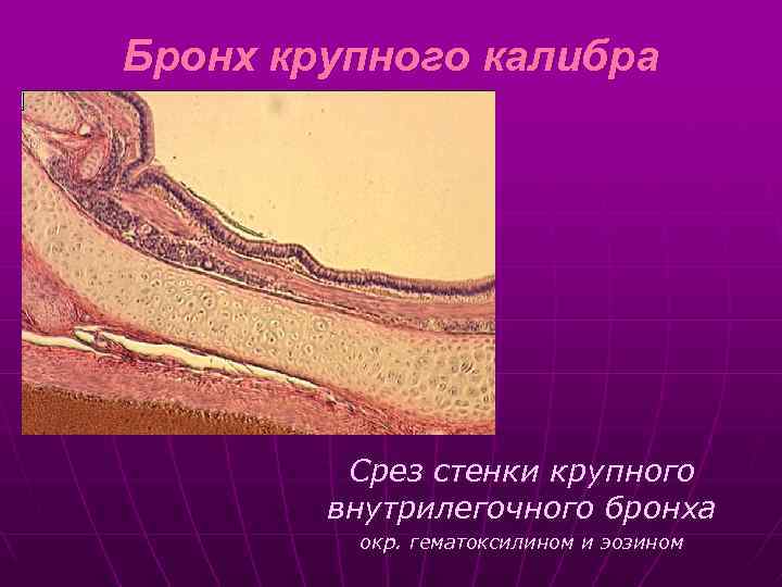Бронх крупного калибра Срез стенки крупного внутрилегочного бронха окр. гематоксилином и эозином 