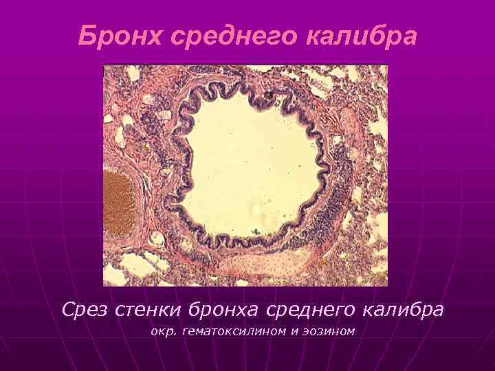 Бронх среднего калибра Срез стенки бронха среднего калибра окр. гематоксилином и эозином 