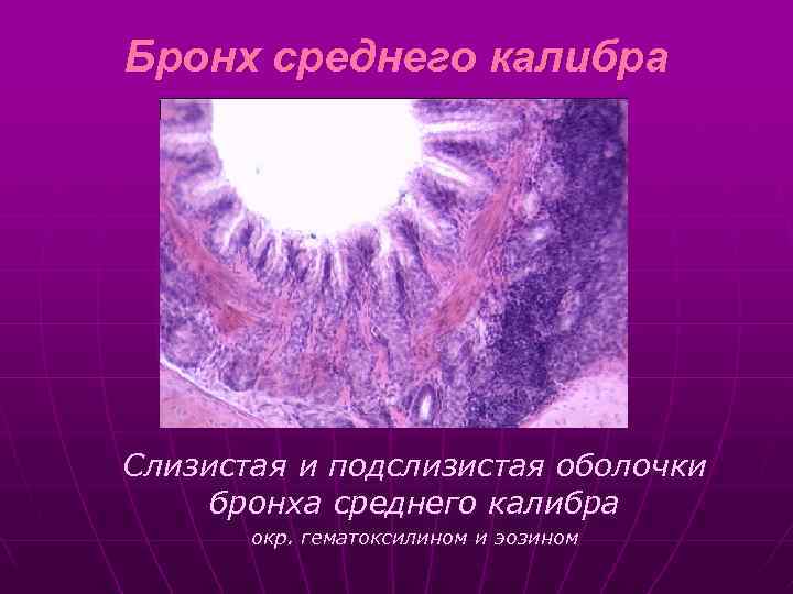 Бронх среднего калибра Слизистая и подслизистая оболочки бронха среднего калибра окр. гематоксилином и эозином