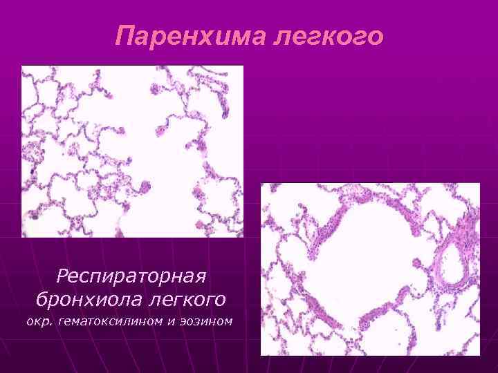Паренхима легкого Респираторная бронхиола легкого окр. гематоксилином и эозином 